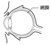 網膜症